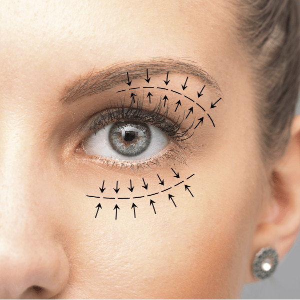 Ilustração das regiões superior e inferior avaliadas na blefaroplastia